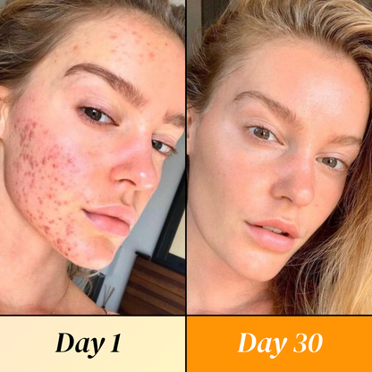 Brightening Orange Enzyme Exfoliating Gel